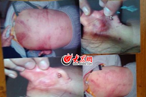 　山東藝術(shù)設(shè)計(jì)學(xué)院16歲女生宿舍內(nèi)被女同學(xué)暴打4小時(shí)。