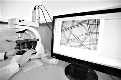 顯微鏡下，聚酯纖維很光亮，表面有斑點(diǎn)，粗細(xì)非常均勻。