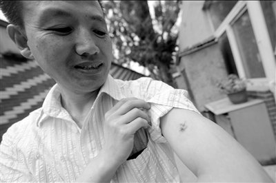 郭學(xué)江制服狂徒時(shí)被咬傷。京華時(shí)報(bào)記者潘之望攝