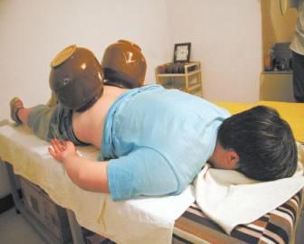 拔泡菜壇子火罐。