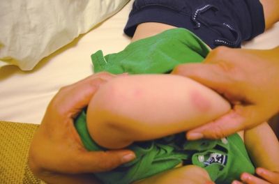 孩子身上有多處明顯傷痕。京華時(shí)報(bào)讀者供圖