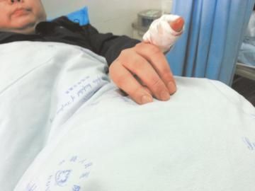 實(shí)習(xí)醫(yī)生陳洪左手的小拇指肌腱斷裂。