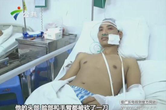 另一名傷者頭部、臉部和手臂都被砍了一刀。(視頻截圖)