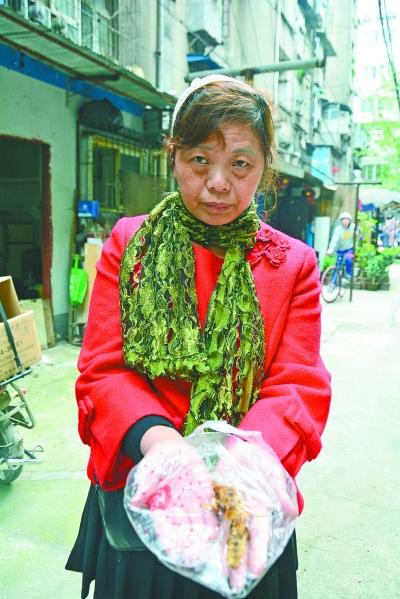 頭部受傷的黃女士展示兩根大魚刺。