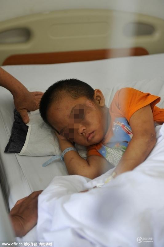 圖為全身傷痕累累的小進(jìn)。