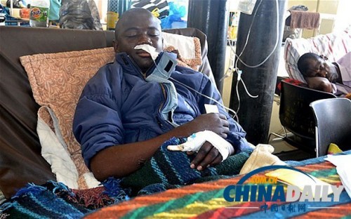 雖然已經(jīng)在醫(yī)院接受了近一個月的恢復(fù)治療，卡托卡的身體仍然非常虛弱。