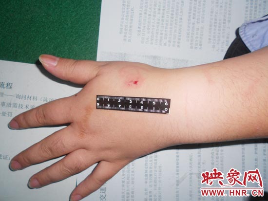 為幫助無證駕駛的朋友逃避處罰，新鄉(xiāng)的王某竟對執(zhí)勤民警大打出手，還將一名民警的手臂咬傷