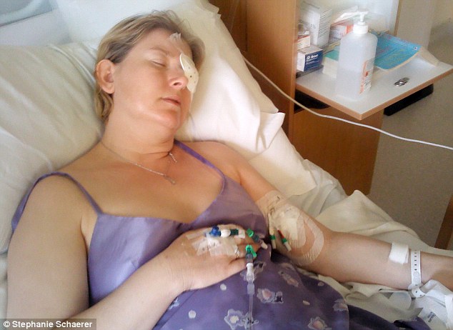 恐怖慎入！隱形眼鏡致英女子摘除眼球