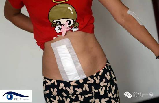 小金腹部的傷口。