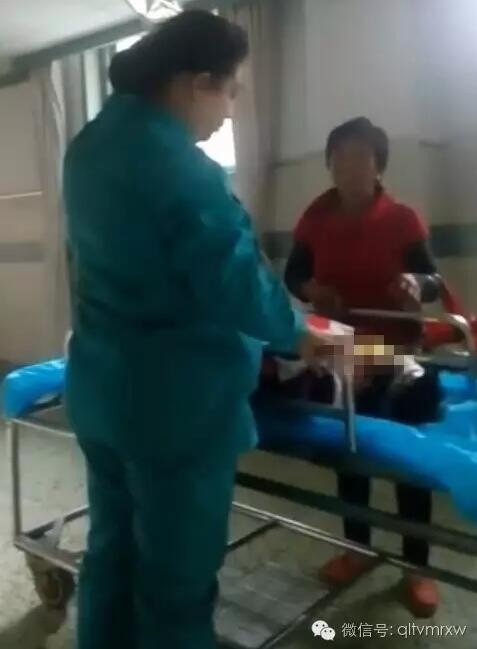 涵涵爸爸告訴《每日新聞》記者：“沒想到是熱水，大人也沒看，一時(shí)疏忽，掉進(jìn)去了。抱出來的時(shí)候這個(gè)皮已經(jīng)掉了。”