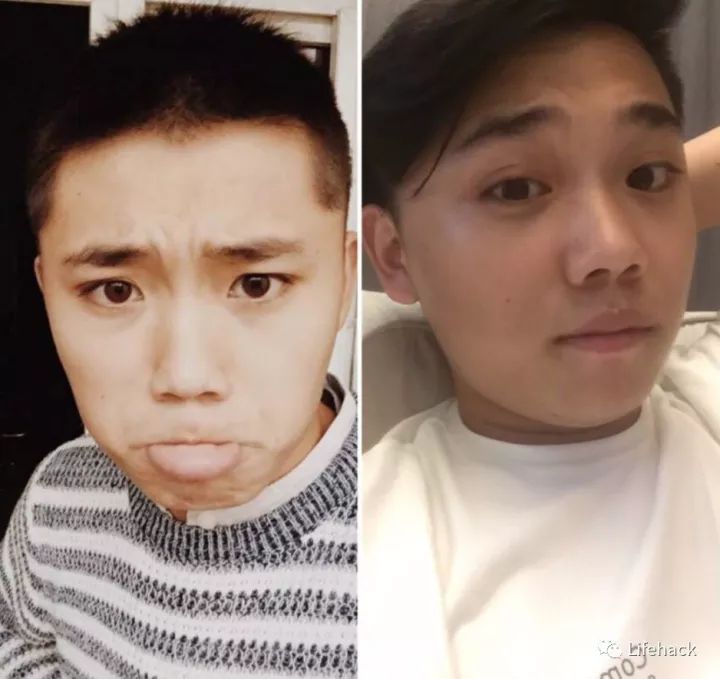 長胖20斤，臉型怎么變？這些例子看完扎心了！