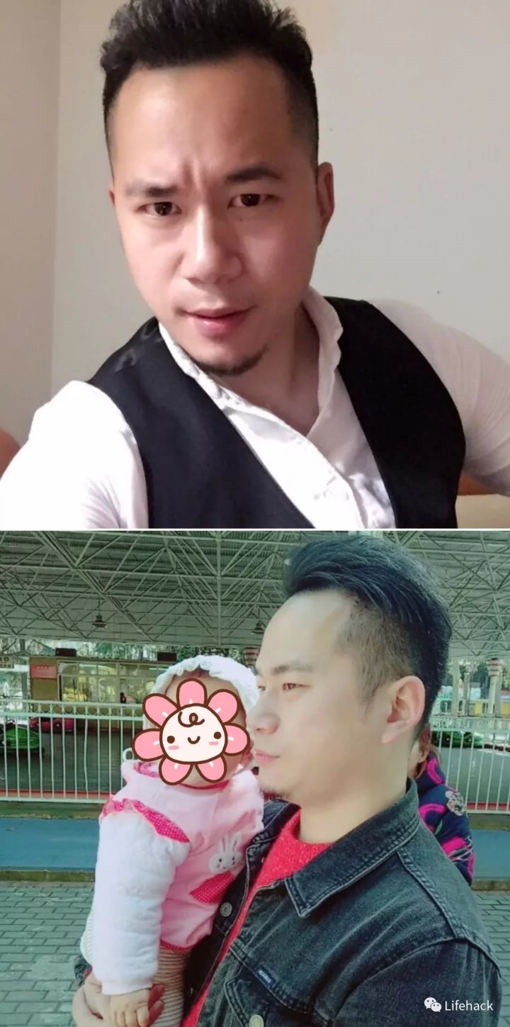 長胖20斤，臉型怎么變？這些例子看完扎心了！