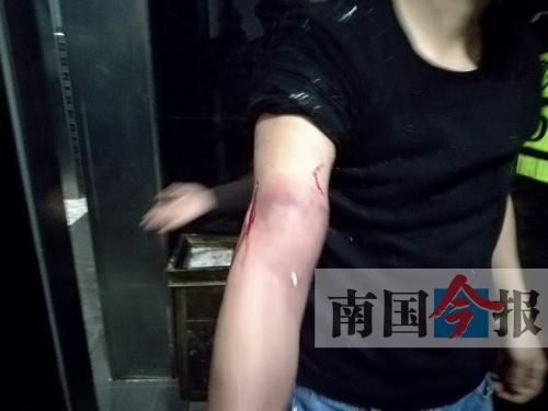 覃先生手臂被卡的部位受傷流血，所幸傷勢(shì)無大礙。 通訊員 王建民 攝