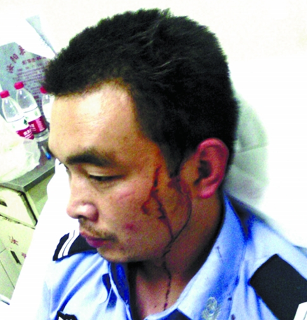 汝陽(yáng)協(xié)警遭賭徒暴力抗法并圍毆 公安局稱這是內(nèi)部的事