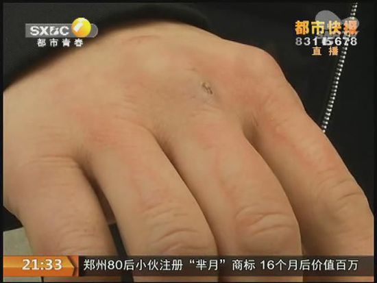 說(shuō)到這足療拔罐，估計(jì)大伙都不陌生，但是想起4號(hào)晚上的拔罐的經(jīng)歷，呂先生現(xiàn)在想起來(lái)，還心有余悸。