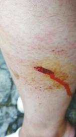 郭女士腿上被猴子咬的傷口。(受訪者供圖)