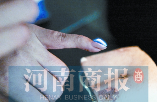 將指甲油涂在指甲上，靠近火焰時(shí)被引燃了