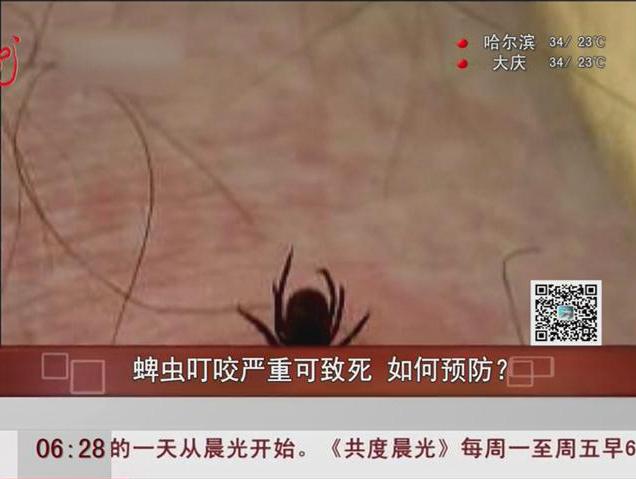 蜱蟲叮咬嚴重可致死如何預防？