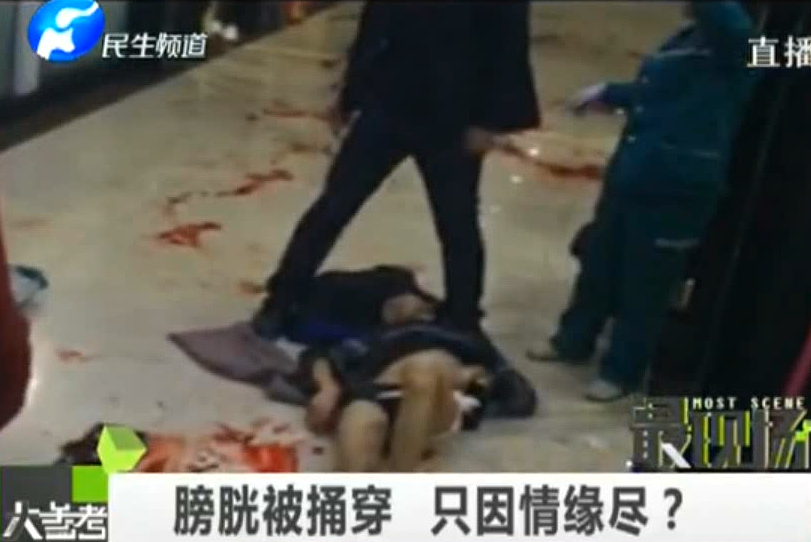 膀胱被捅穿 只因情緣盡？